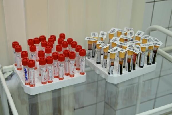 В Москве более 165 тысяч человек сдали тесты на антитела к COVID-19